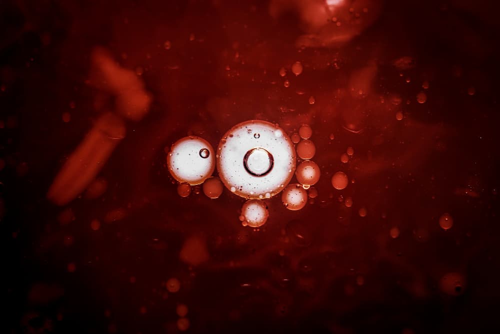 Eosinofil: Fungsi dan Kadar Normal