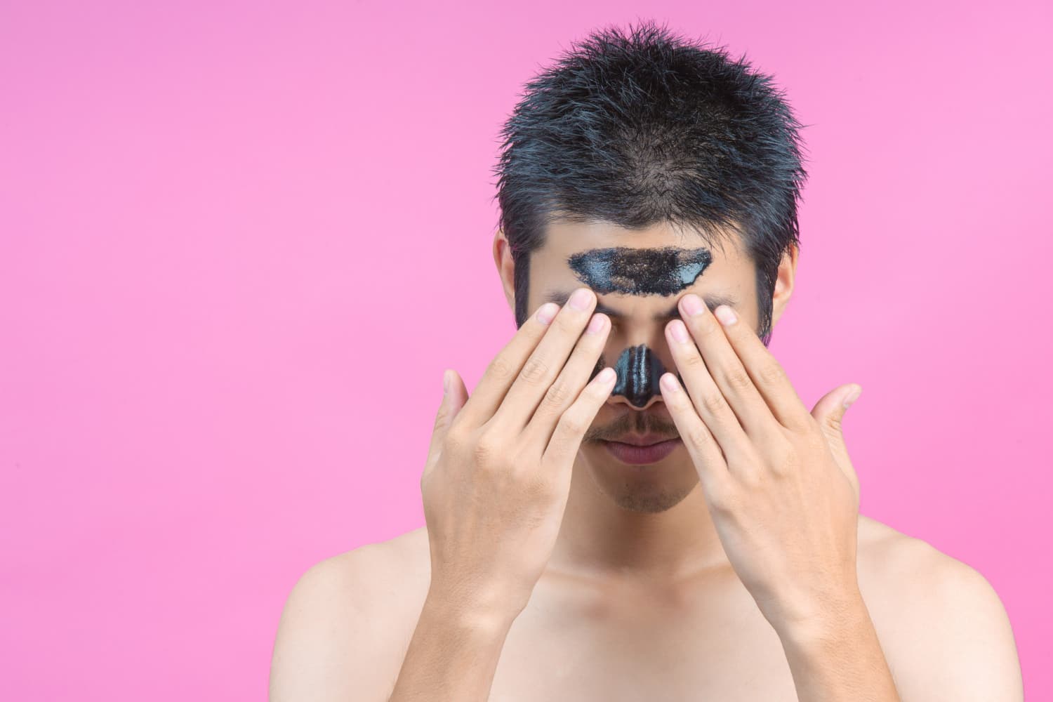 Close Komedo: Penyebab, Cara Mengenali, dan Cara Mengatasinya dengan Aman