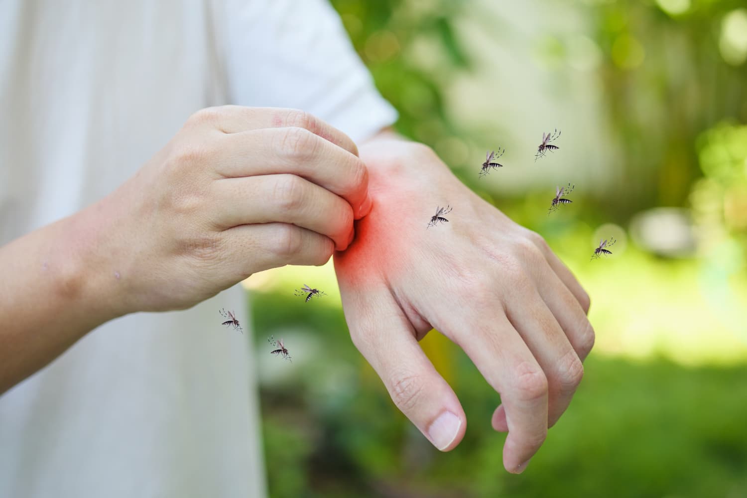 Malaria: Gejala, Penyebab, Tanda Bahaya, dan Cara Mencegahnya