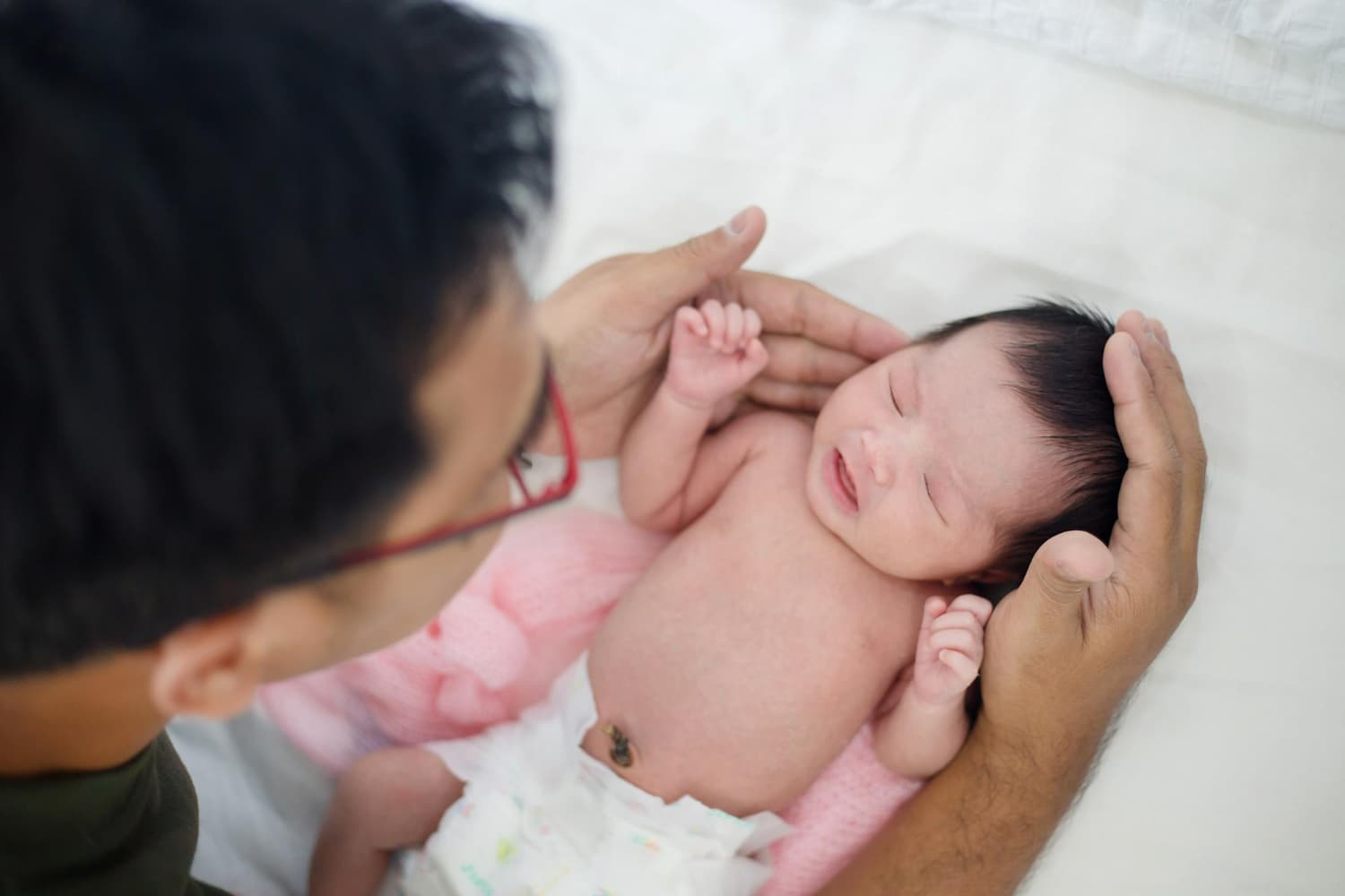 Hernia Umbilikalis: Penyebab, Gejala, dan Cara Mengatasinya