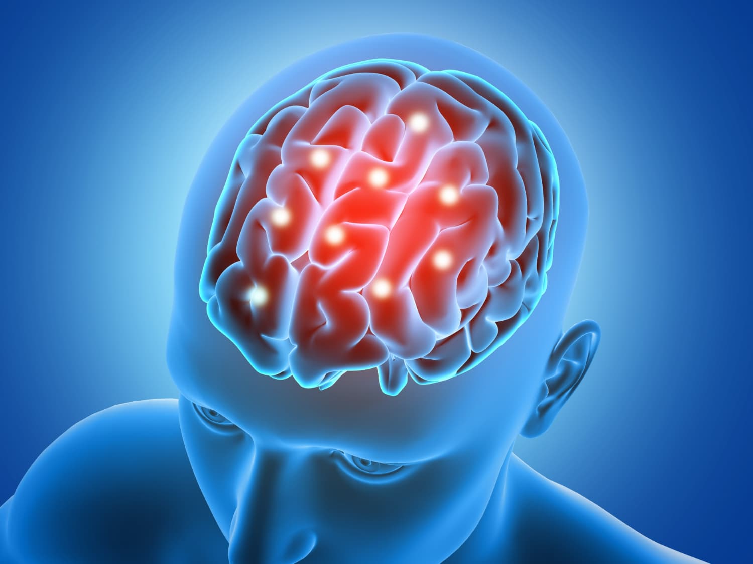 Empty Sella Syndrome: Gejala, Penyebab, dan Penanganannya