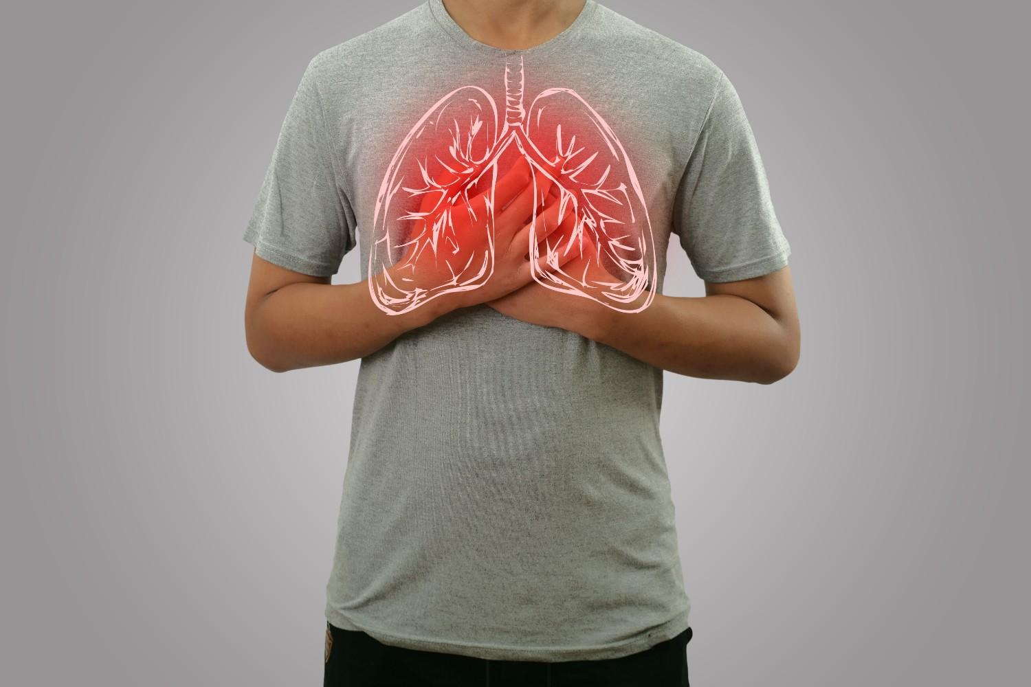 penyebab-dan-gejala-pneumonia