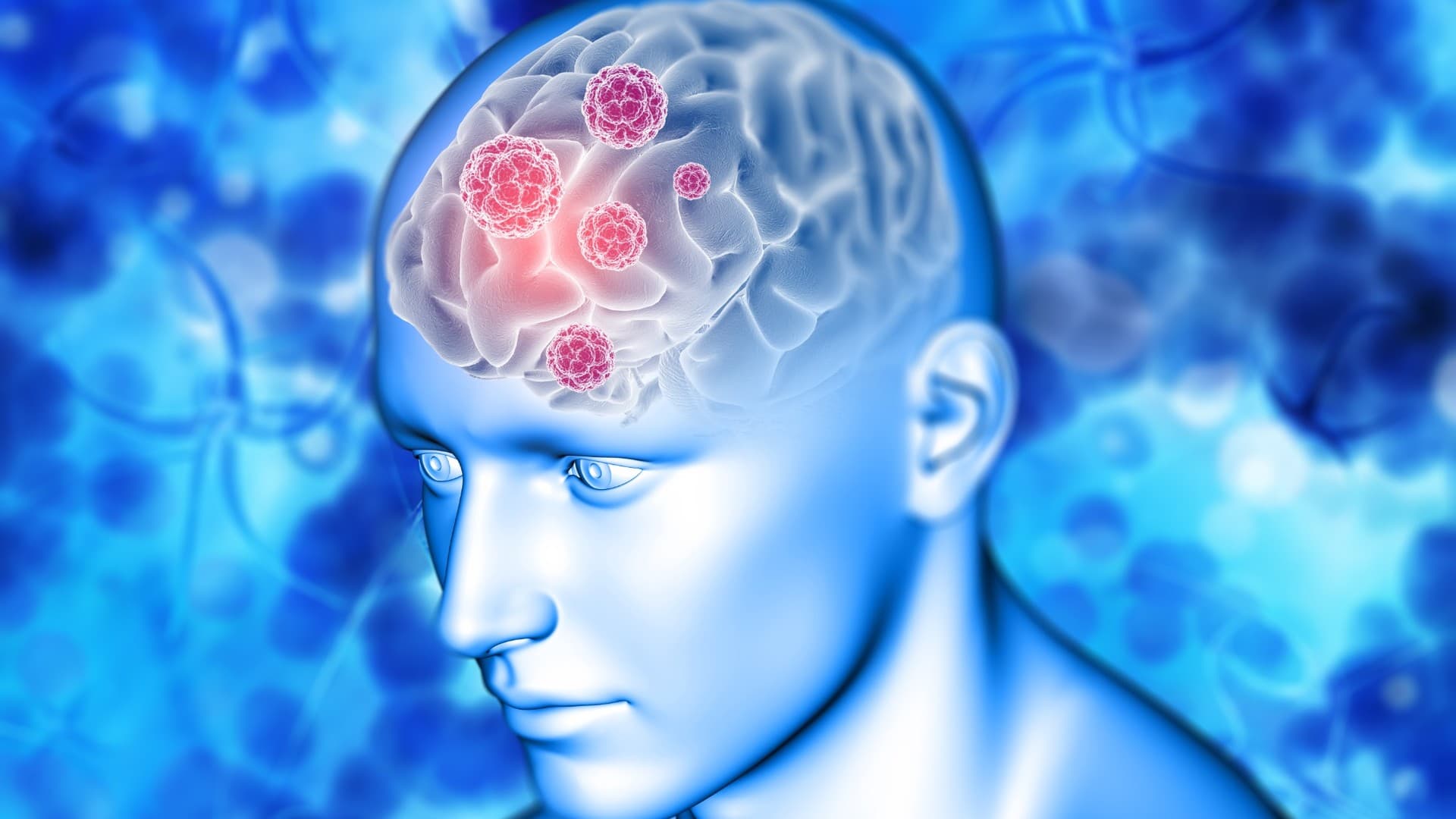 Berapa Biaya Vaksin Meningitis? Kenali Jenis, Jadwal, dan Persiapannya