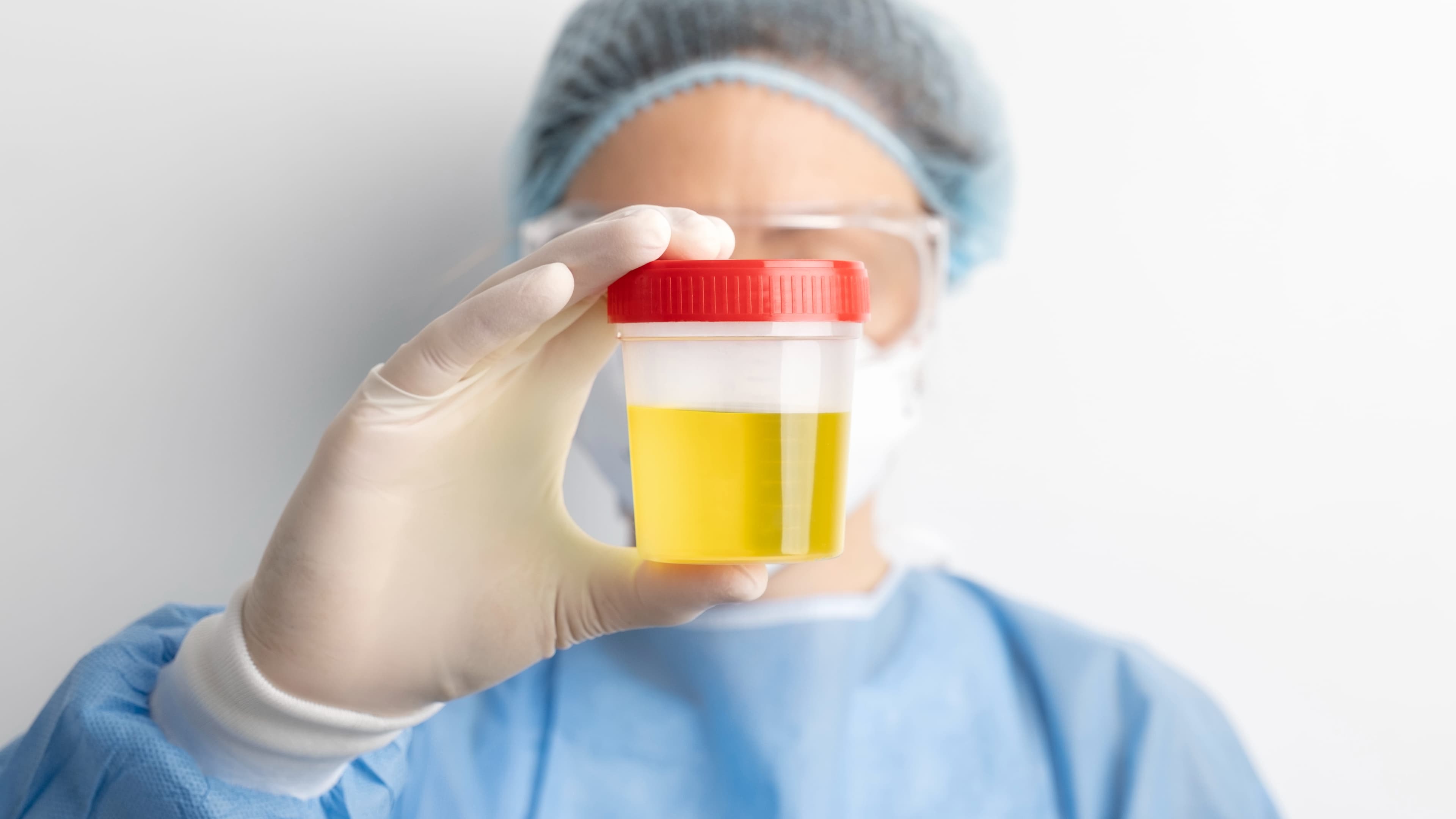 Tes Urine untuk Apa? Kenali Fungsi, Jenis, hingga Cara Membaca Hasilnya