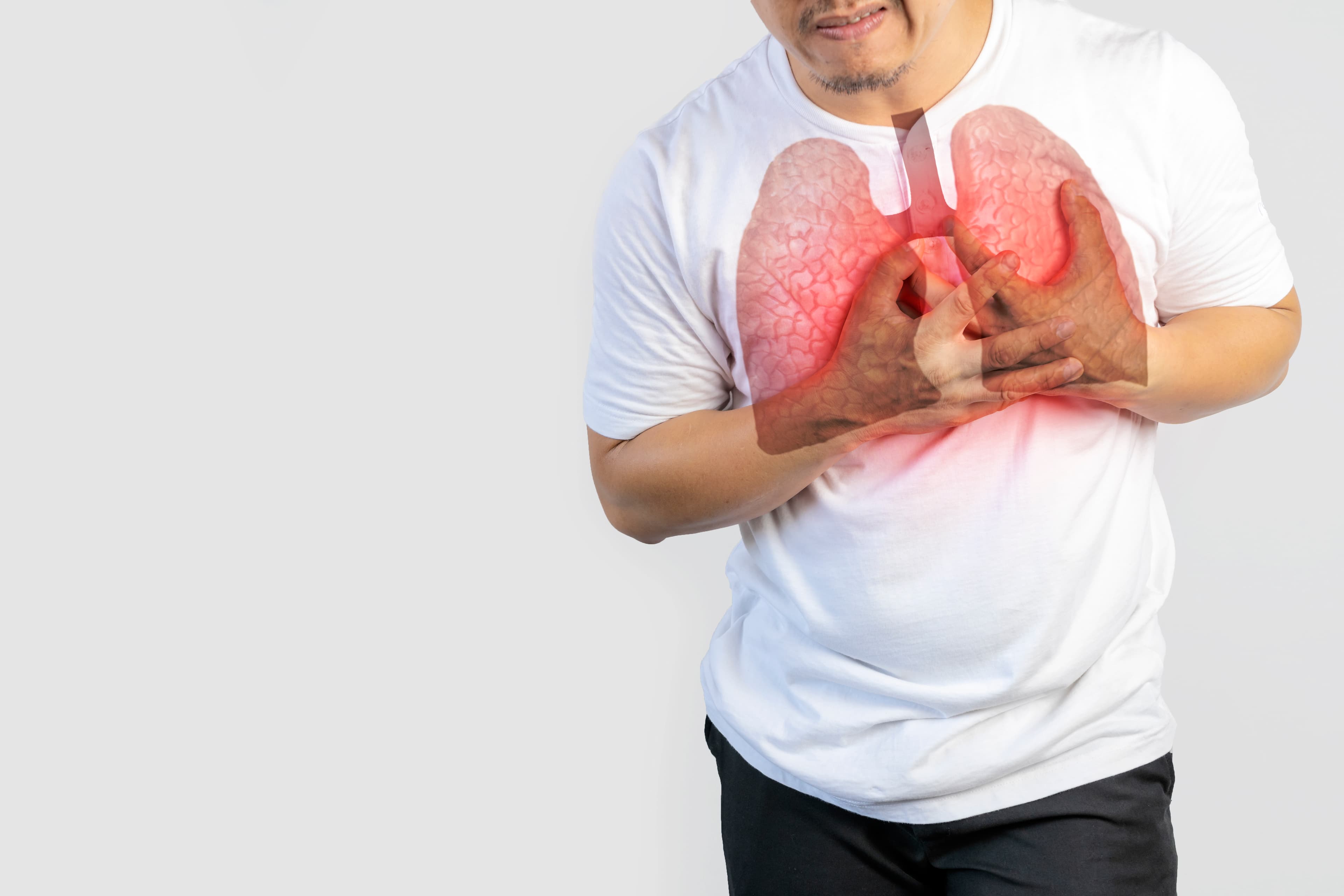 Emfisema Adalah: Pengertian, Penyebab, Gejala, dan Cara Dokter Memastikannya
