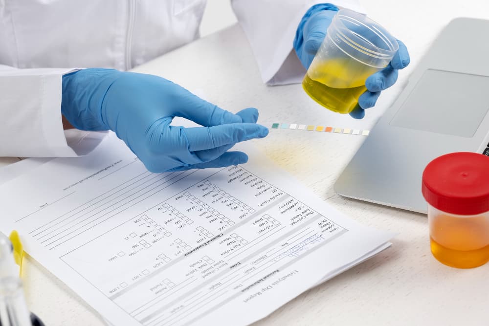 Mikroalbumin Urine Adalah: Fungsi Tes, Nilai Normal, dan Cara Membaca Hasilnya