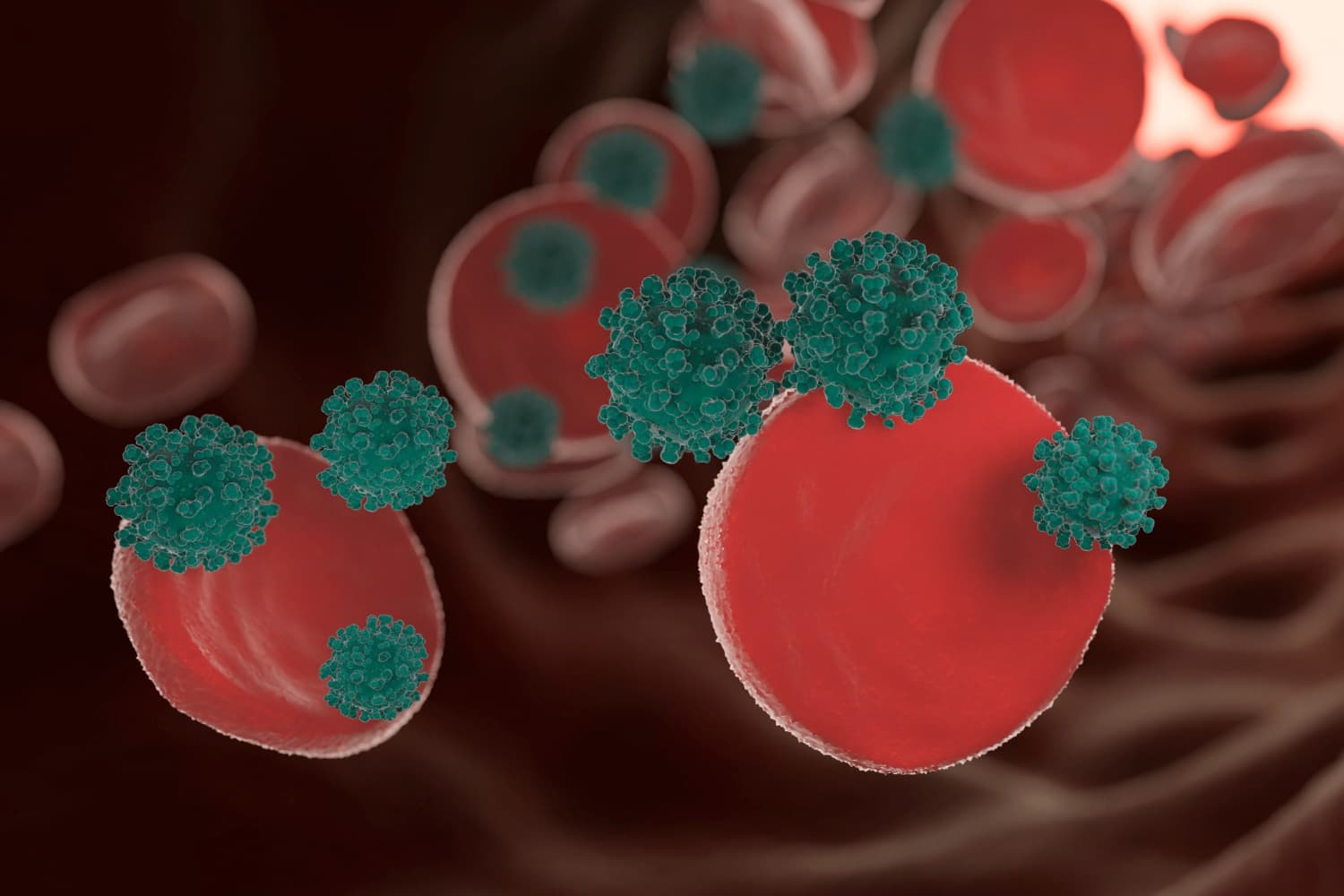 Neutropenia Adalah: Penyebab, Gejala, dan Pengobatan