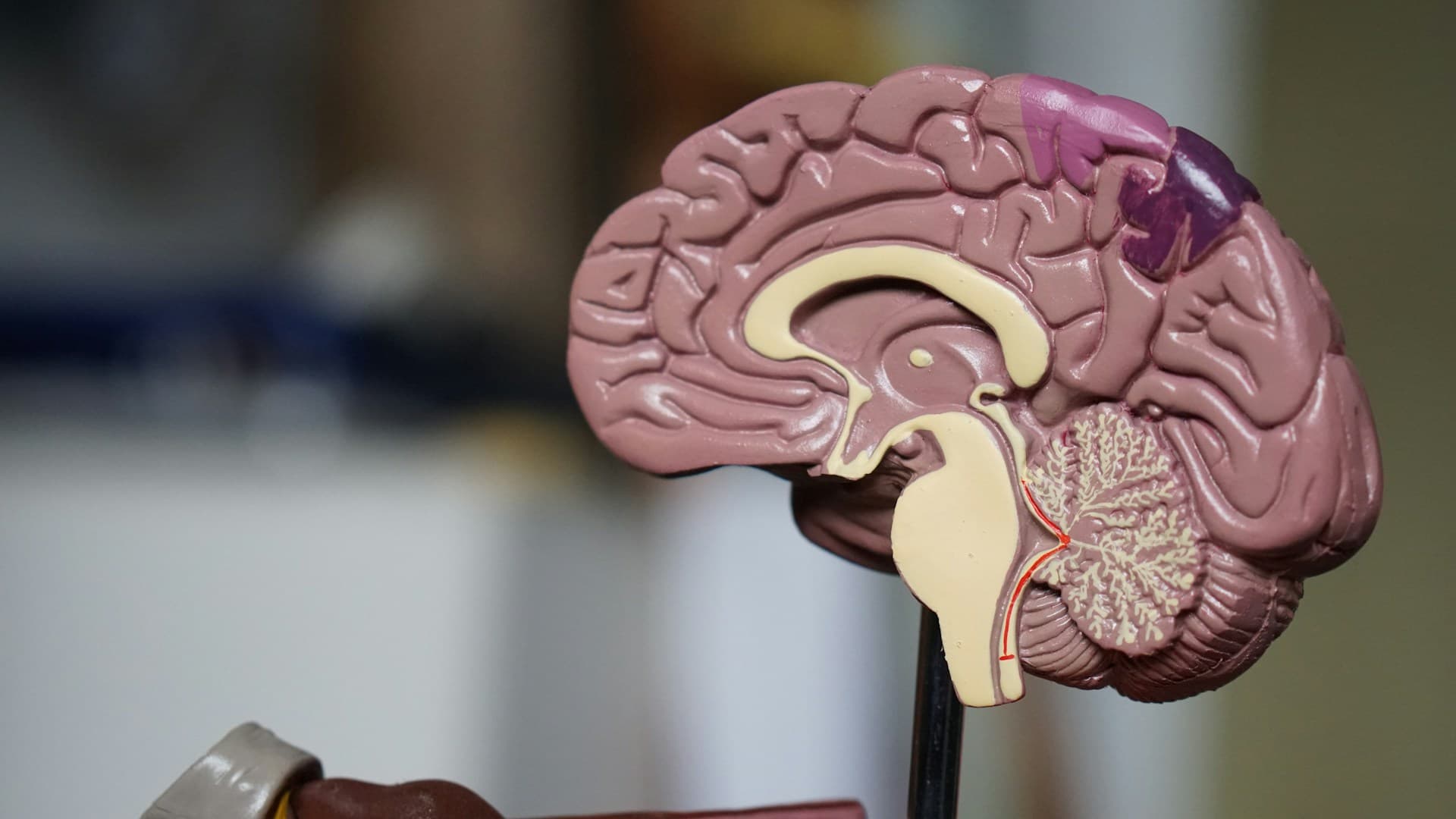 Meningioma: Gejala, Penyebab dan Penanganannya