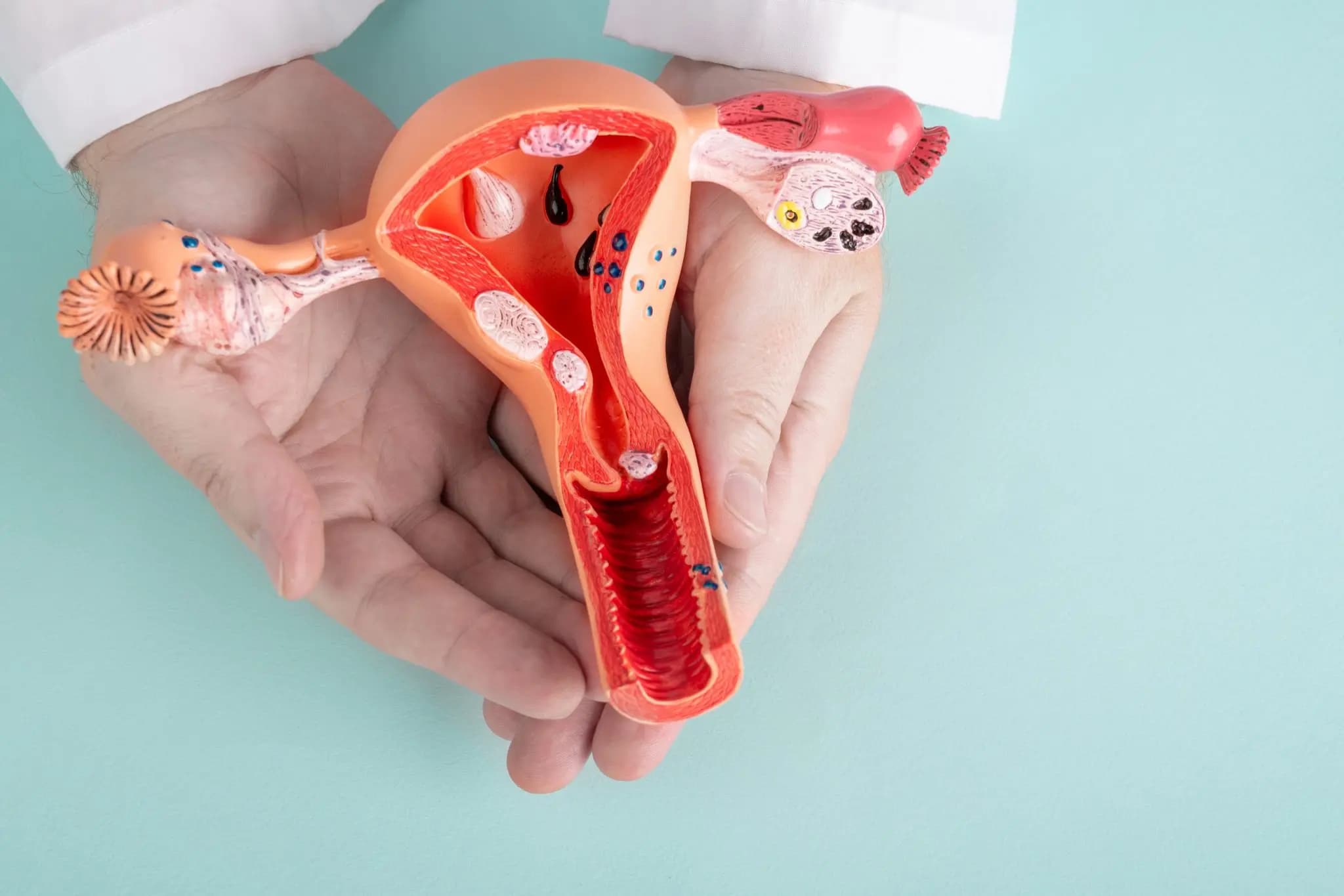 Pemeriksaan Kanker Serviks: Perbedaan Pap Smear, HPV DNA, dan IVA
