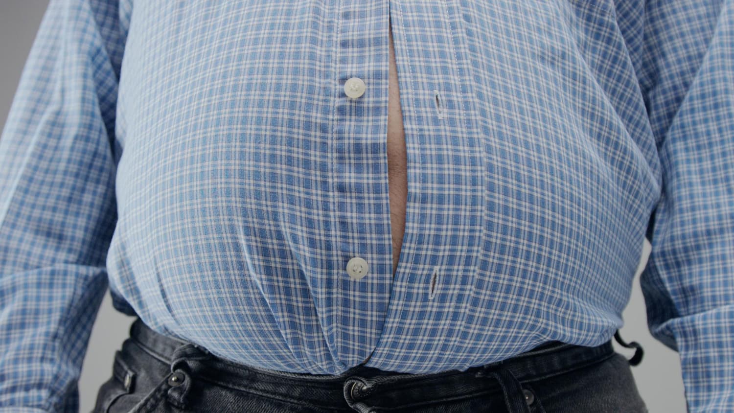 Penyebab obesitas atau kelebihan berat badan