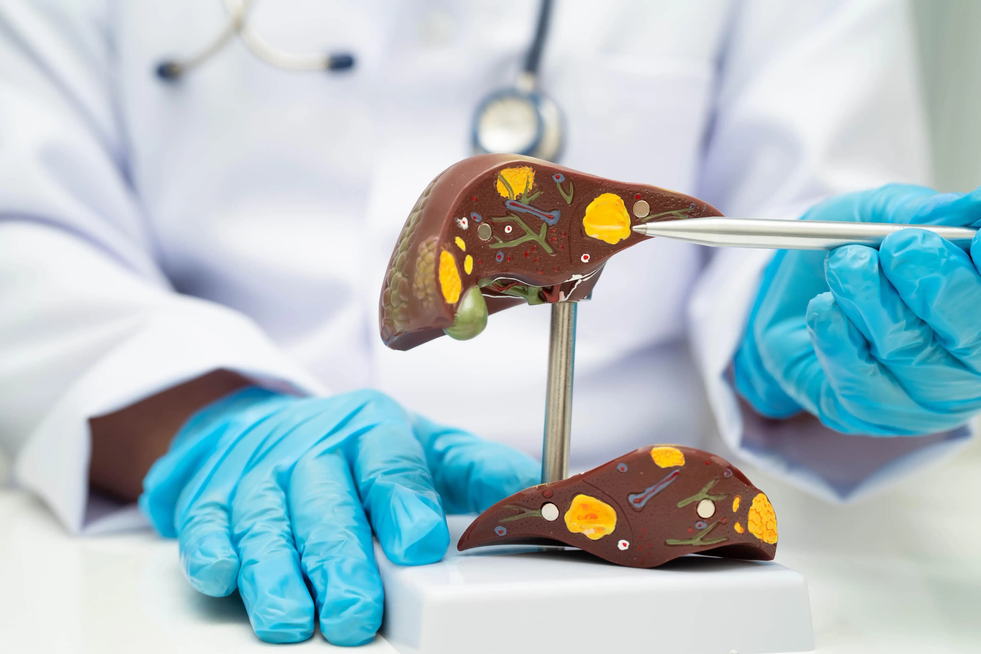 Mengenal Hepatitis A, B, dan C: Gejala, Pencegahan, dan Pentingnya Vaksin Hepatitis B