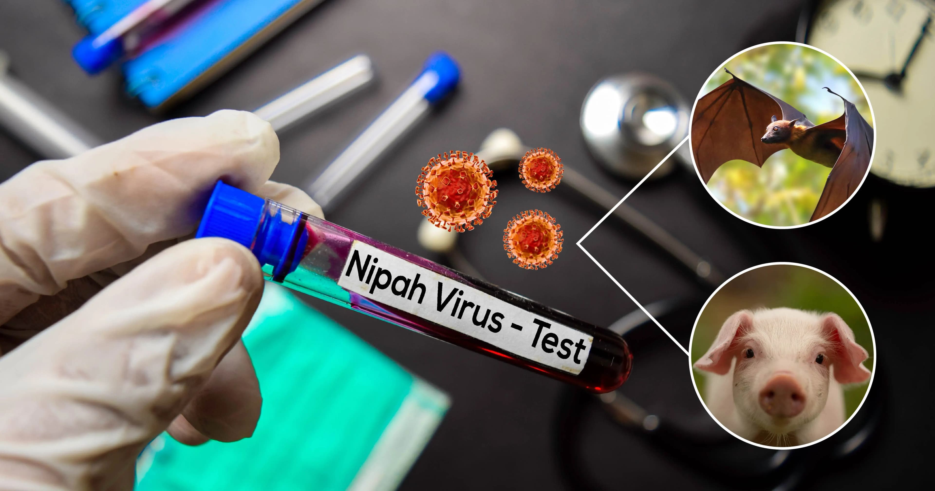 Waspada Virus Nipah