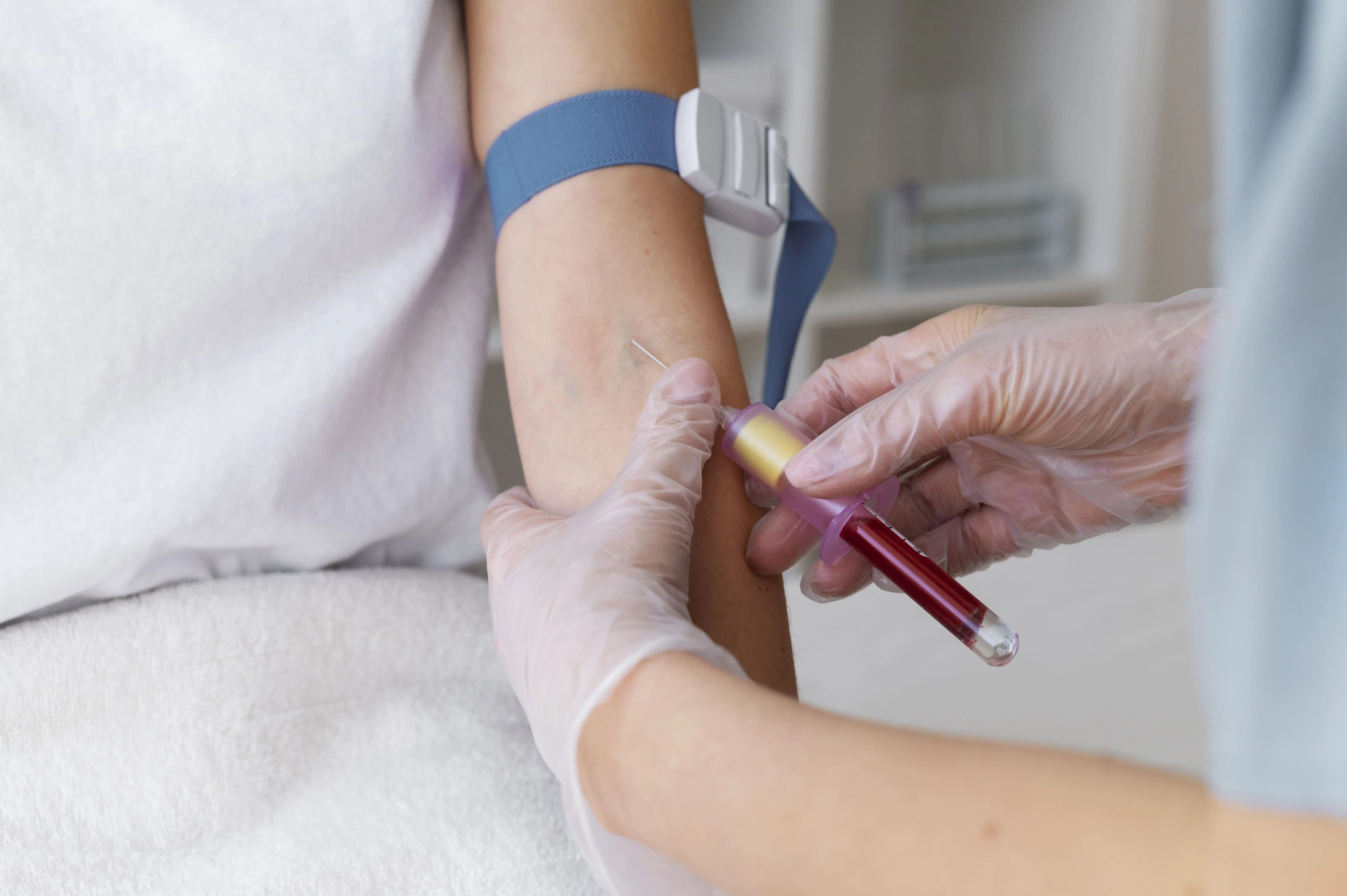 Skrining Thalassemia: Cara Deteksi Dini Sebelum Menikah dan Memiliki Anak