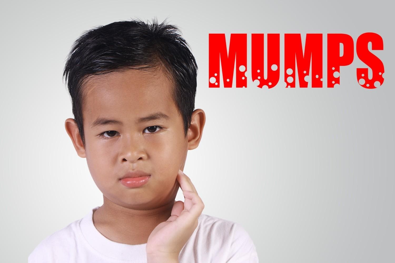 Gondongan Menular? Ini Penyebab, Gejala, dan Cara Mencegahnya