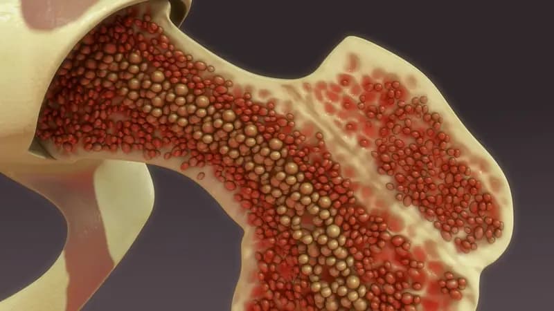 Bone Marrow Puncture: Menyingkap Rahasia Kesehatan dari Dalam Tulang