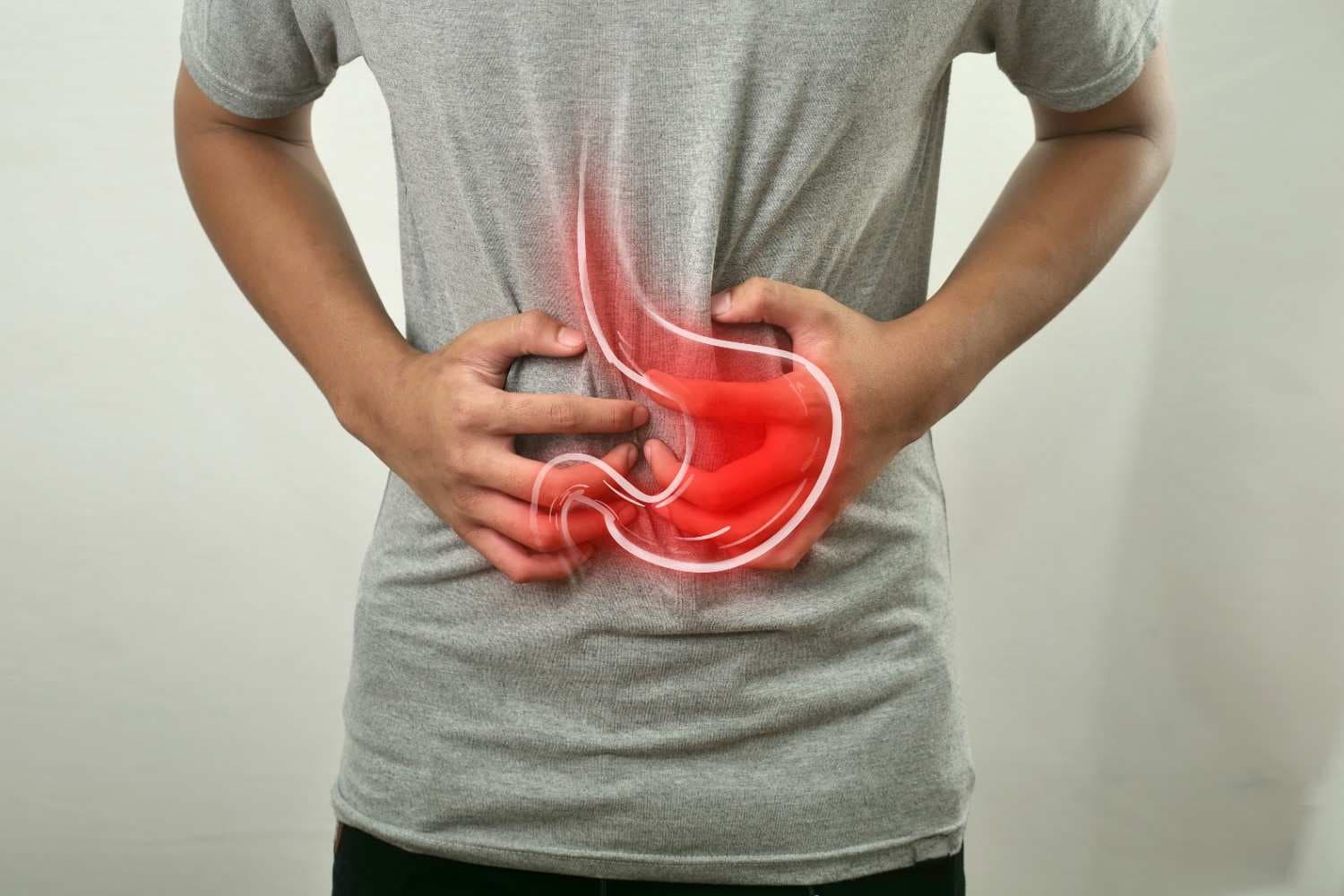 Penyebab GERD: Lebih dari Sekadar Salah Makan