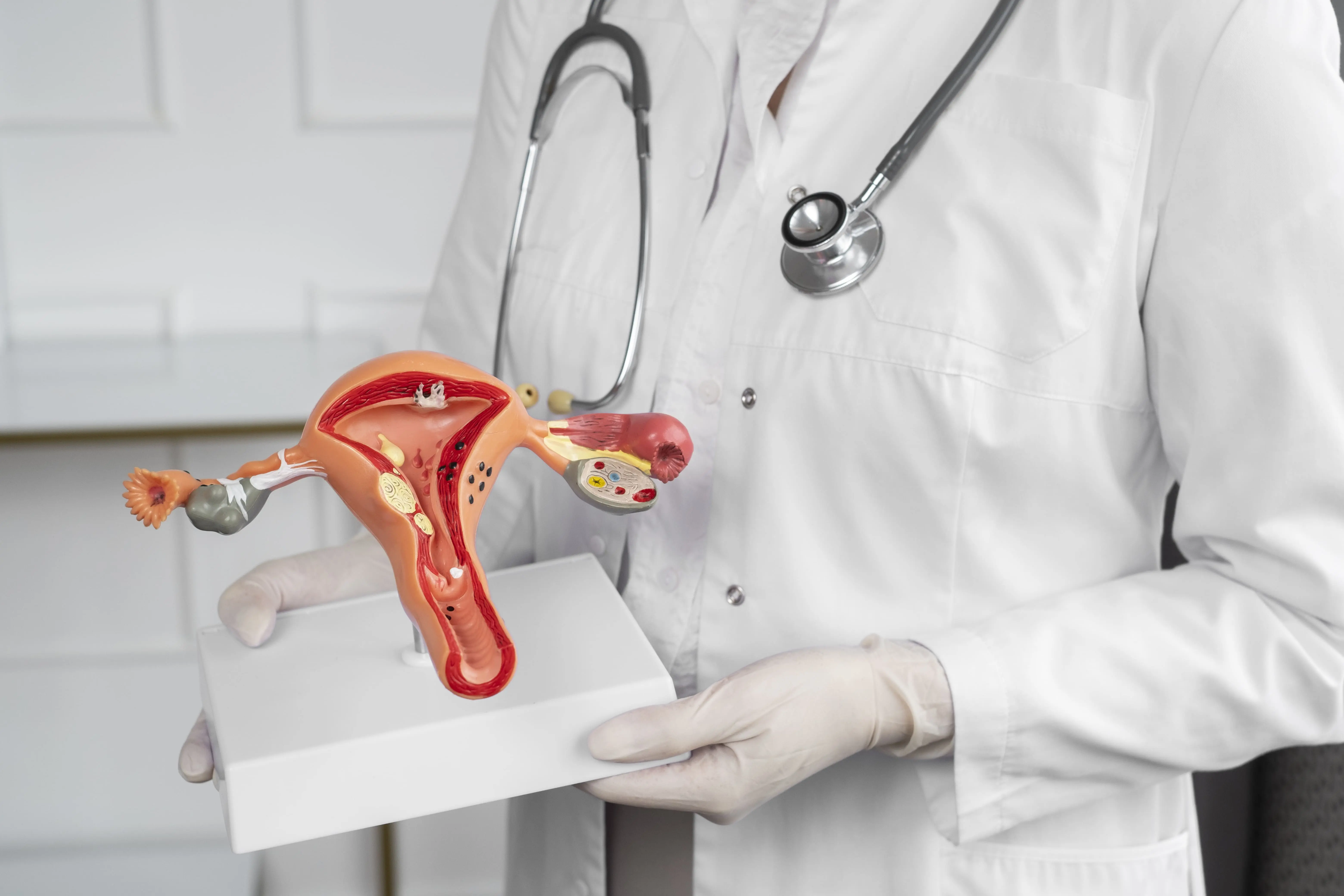 CA125 dan Tantangan Diagnostik dalam Kanker Ovarium: Apa yang Perlu Diketahui?