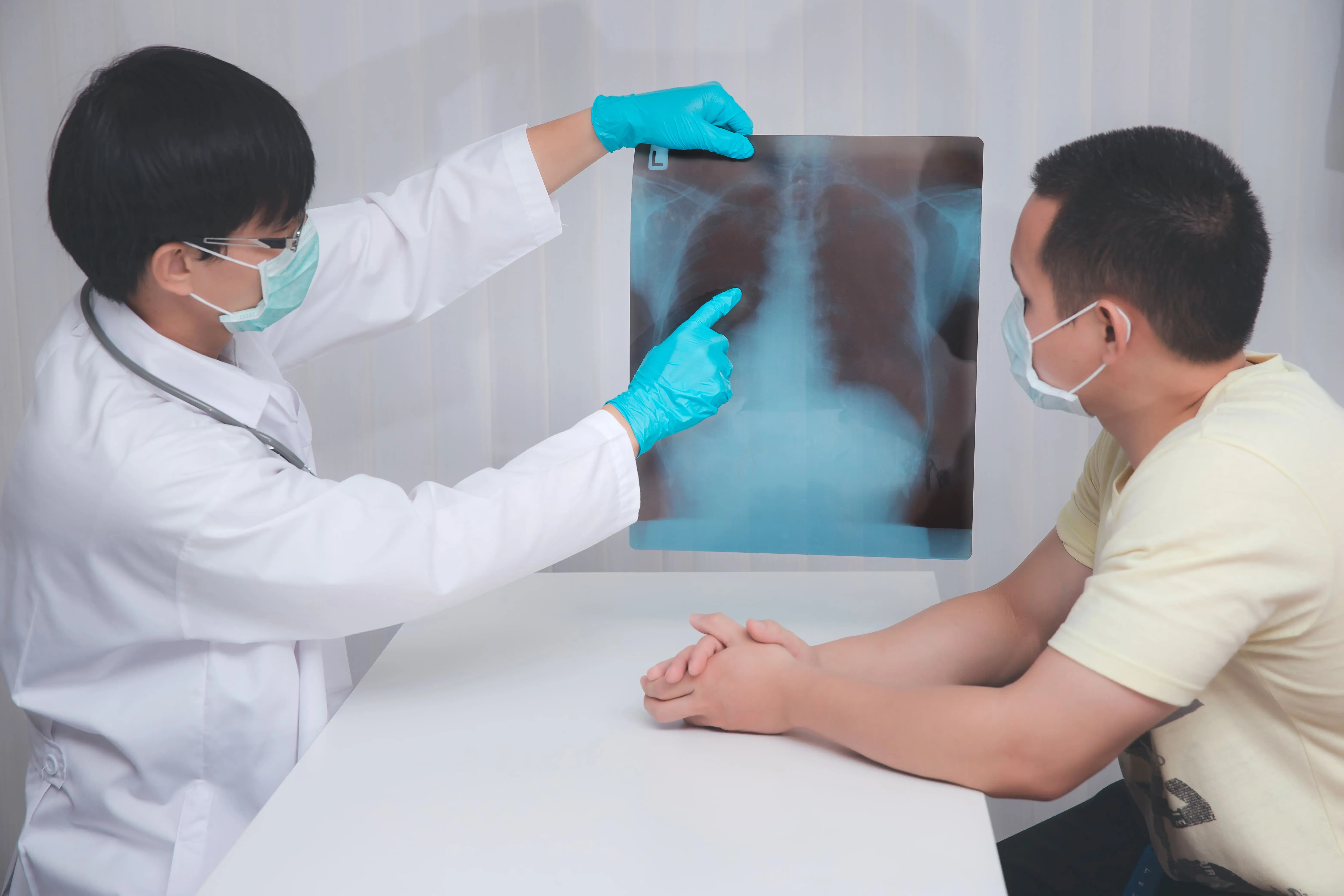 Kenali Mesothelioma Pleura, Kanker yang Menyerang Selaput Paru-paru