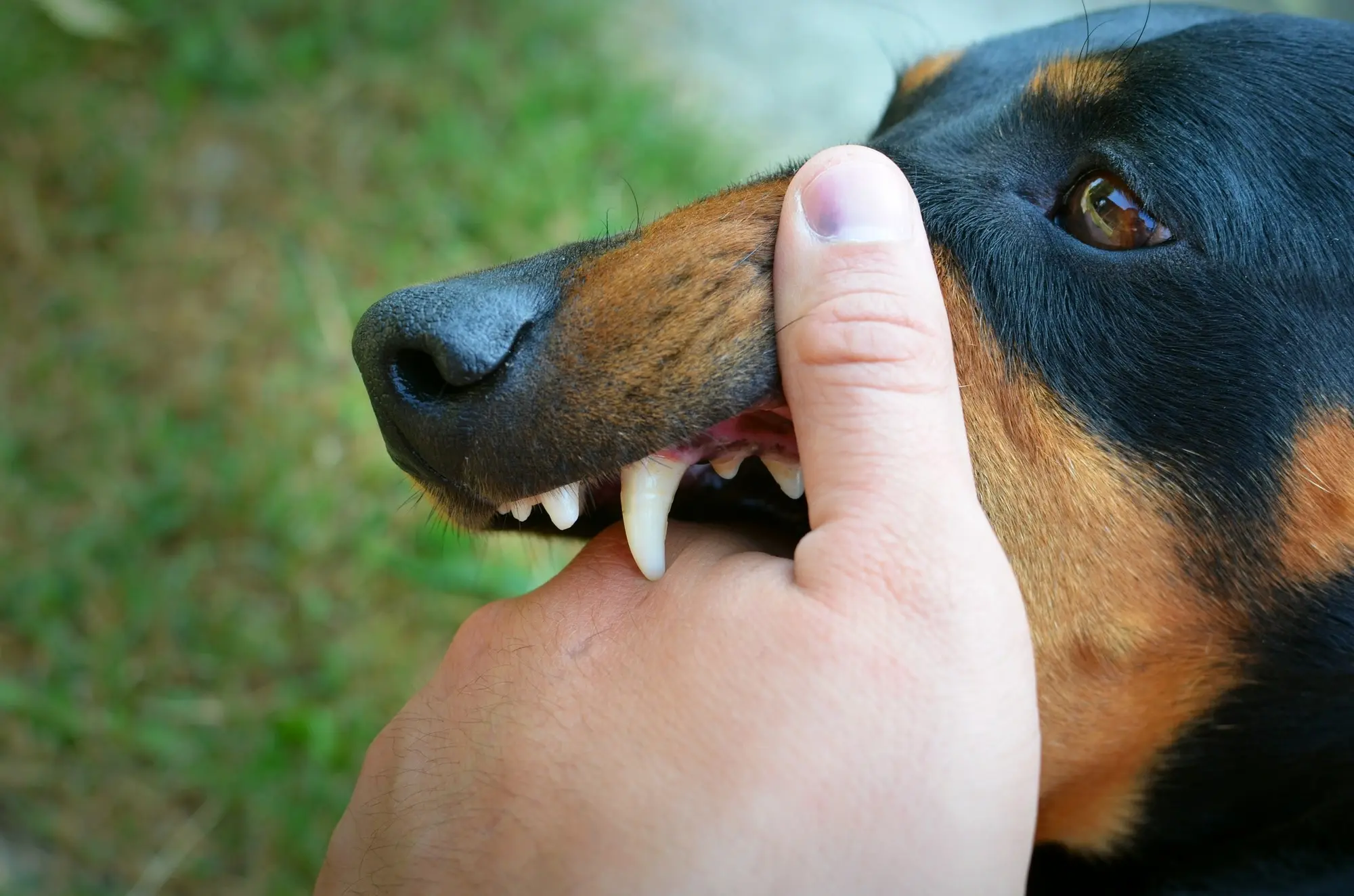 Rabies: Dari Gigitan dan Cakaran Hewan Dapat Berujung Mematikan!
