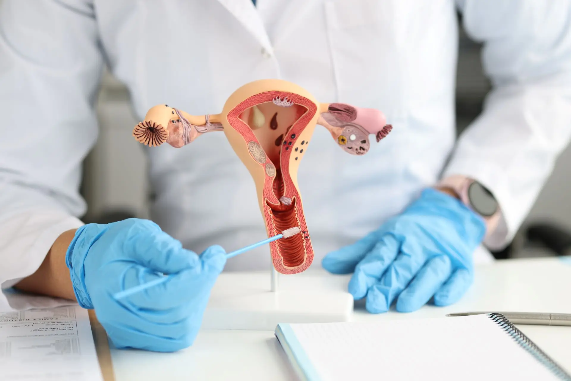 Perbedaan Tes HPV DNA dengan Pap Smear: Mana yang Lebih Akurat?
