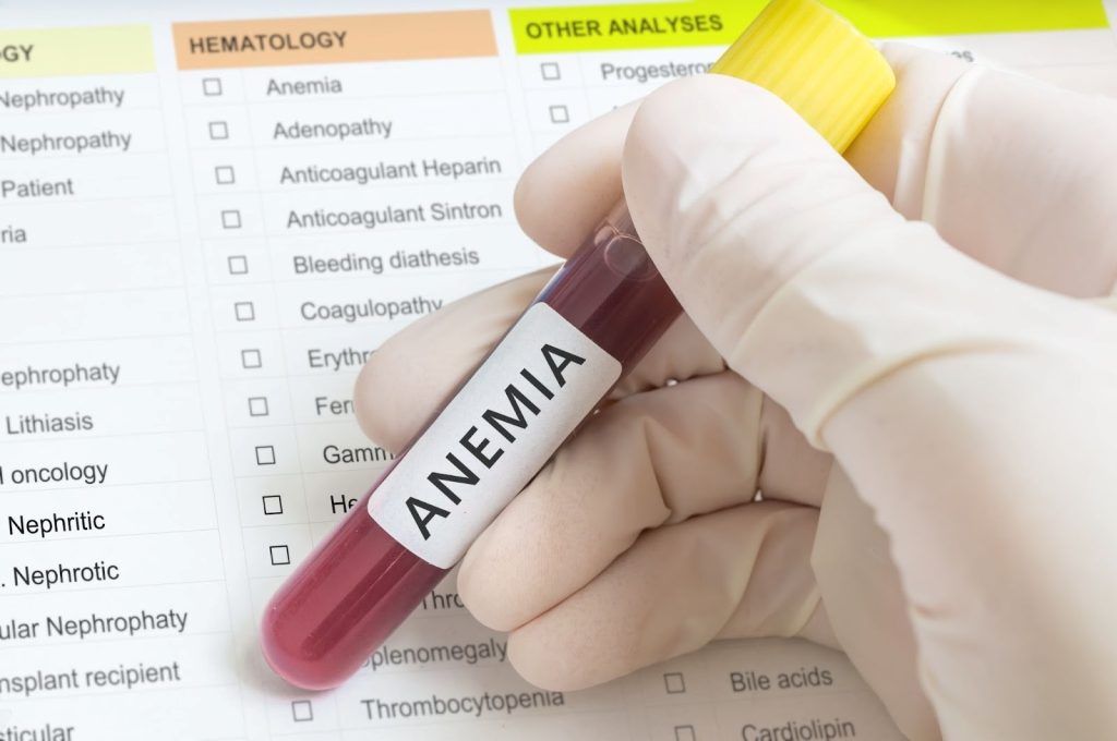 hasil tes anemia