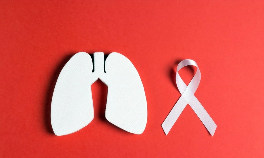 pengobatan kanker paru paru